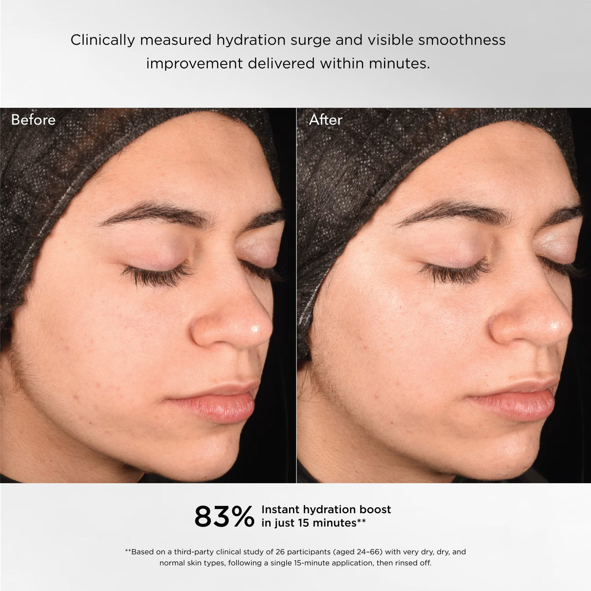 Regenerating Youth Masque