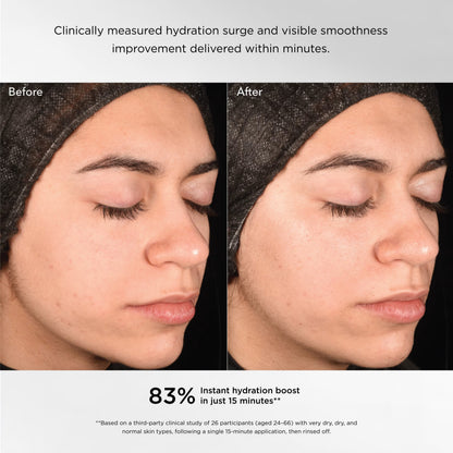 Regenerating Youth Masque