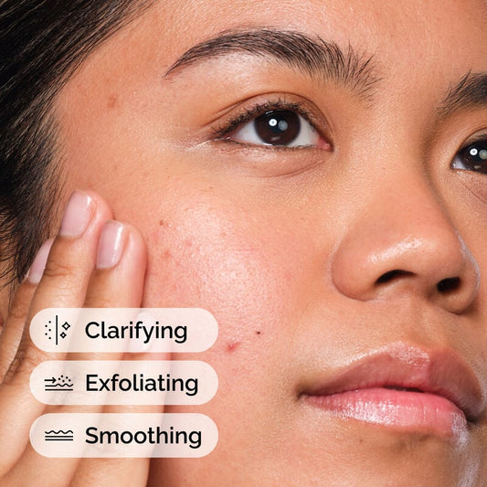 Salicylic Acid 2% Solution
